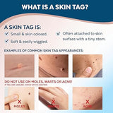 Claritag Advanced Skin Tag Remover, FDA-Cleared Skin Tag Removal in Just 1 Treatment Cycle, Cryogenic Freeze-Off Kit for Mild, Clean and Easy at Home Use, Good for Up to 10 Treatment Cycles